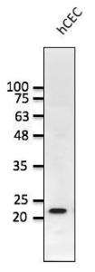 hCEC cell lysate detected with Anti-RAB1B Antibody at a 1:1,000 dilution. Lysate at 50 µg and rabbit anti-goat IgG antibody (HRP) at a 1:10,000 dilution