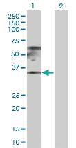 Anti-RPL17 Rabbit Polyclonal Antibody