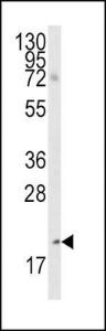 Anti-BMF Rabbit Polyclonal Antibody (FITC (Fluorescein))