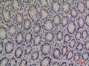 Immunohistochemical analysis of paraffin-embedded human colon using Anti-SERPINA4 Antibody