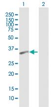 Anti-PSTPIP2 Mouse Polyclonal Antibody