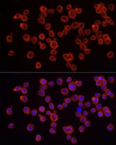 Immunofluorescence analysis of RAW264. 7 cells using Anti-IRAK4 Antibody (A307561) at a dilution of 1:50 (40X lens). DAPI was used to stain the cell nuclei (blue)