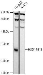 Western blot analysis of extracts of various cell lines, using Anti-HSD17B13 Antibody [ARC52038] (A308534) at 1:1,000 dilution. The secondary antibody was Goat Anti-Rabbit IgG H&L Antibody (HRP) at 1:10,000 dilution.