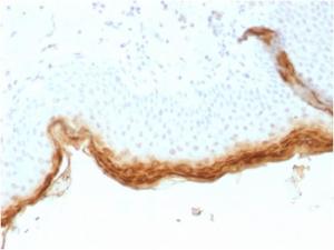 Immunohistochemical analysis of formalin-fixed, paraffin-embedded human skin using Anti-Filaggrin Antibody [rFLG/1561]