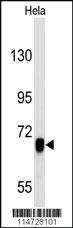 Anti-EGFR Rabbit Polyclonal Antibody