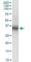 Anti-CER1 Polyclonal Antibody Pair