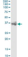 Anti-CER1 Antibody Pair