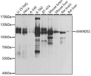 Western blot analysis of extracts of various cell lines, using Anti-ANKRD52 Antibody (A308535) at 1:1,000 dilution. The secondary antibody was Goat Anti-Rabbit IgG H&L Antibody (HRP) at 1:10,000 dilution.