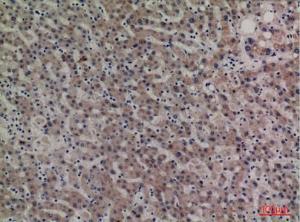 Immunohistochemical analysis of paraffin-embedded human liver using Anti-SERPINA4 Antibody