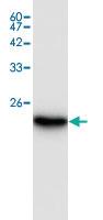 Anti-IL18 Rabbit Polyclonal Antibody