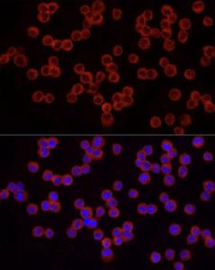 Immunofluorescence analysis of THP-1 cells using Anti-IRAK4 Antibody (A307561) at a dilution of 1:50 (40X lens). DAPI was used to stain the cell nuclei (blue)