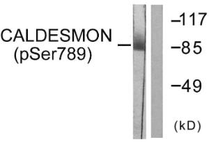 Western blot analysis of lysates from HeLa cells treated with EGF 200ng/ml 30' using Anti-Caldesmon (phospho Ser789) Antibody. The right hand lane represents a negative control, where the antibody is blocked by the immunising peptide