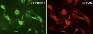 Primary fibroblasts, transduced with GFP-RAB1A, stained with Anti-GFP Antibody