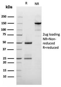 SDS-PAGE analysis of Anti-Filaggrin Antibody [rFLG/1561] under non-reduced and reduced conditions; showing intact IgG and intact heavy and light chains, respectively. SDS-PAGE analysis confirms the integrity and purity of the antibody