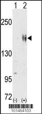 Anti-ERBB2 Rabbit Polyclonal Antibody