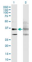 Anti-GPRC5A Mouse Polyclonal Antibody