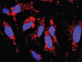 Anti-CRKL + EGFR Polyclonal Antibody Pair