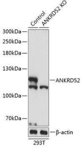 Western blot analysis of extracts from normal (control) and ANKRD52 knockout (KO) 293T cells, using Anti-ANKRD52 Antibody (A308536) at 1:3,000 dilution. The secondary Antibody was Goat Anti-Rabbit IgG H&L Antibody (HRP) at 1:10000 dilution