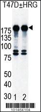 Anti-ERBB2 Rabbit Polyclonal Antibody