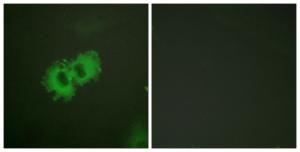 Immunofluorescence analysis of HeLa cells using Anti-Caldesmon (phospho Ser789) Antibody. The right hand panel represents a negative control, where the antibody was pre-incubated with the immunising peptide