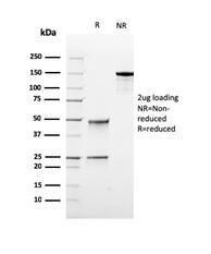 SDS-PAGE analysis of Anti-TOP1MT Antibody [rTOP1MT/488] under non-reduced and reduced conditions; showing intact IgG and intact heavy and light chains, respectively. SDS-PAGE analysis confirms the integrity and purity of the antibody