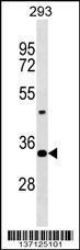 Anti-HOXD9 Rabbit Polyclonal Antibody (Biotin)