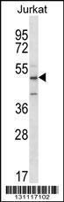 Anti-ABI2 Rabbit Polyclonal Antibody (APC (Allophycocyanin))