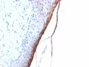 Immunohistochemical analysis of formalin-fixed, paraffin-embedded human skin using Anti-Filaggrin Antibody [FLG/1957R]