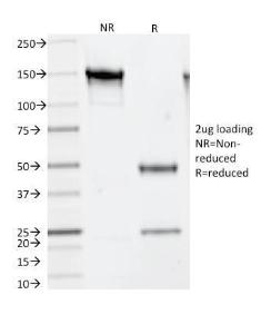 SDS-PAGE analysis of Anti-Thymidylate Synthase Antibody [TS106] under non-reduced and reduced conditions; showing intact IgG and intact heavy and light chains, respectively. SDS-PAGE analysis confirms the integrity and purity of the antibody