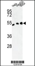 Anti-ALDH3A2 Rabbit Polyclonal Antibody