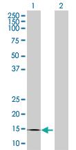 Anti-CREBL2 Mouse Polyclonal Antibody