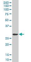 Anti-SIX3 Mouse Monoclonal Antibody [clone: 3D12]