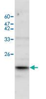 Anti-IL17A Rabbit Polyclonal Antibody