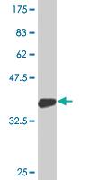 Anti-DBR1 Mouse Monoclonal Antibody [clone: 3A7]