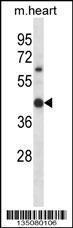 Anti-HOXC11 Rabbit Polyclonal Antibody (Biotin)