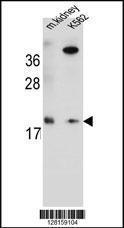 Anti-RN185 Rabbit Polyclonal Antibody (APC (Allophycocyanin))