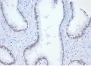 Anti-beta Catenin antibody