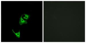 Immunofluorescence analysis of HeLa cells using Anti-GLP1R Antibody. The right hand panel represents a negative control, where the antibody was pre-incubated with the immunising peptide