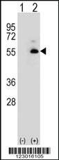 Anti-ALDH3A2 Rabbit Polyclonal Antibody