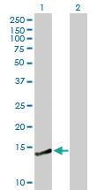 Anti-CREBL2 Mouse Polyclonal Antibody