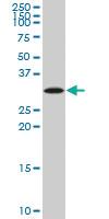 Anti-SIX3 Mouse Monoclonal Antibody [clone: 3D12]