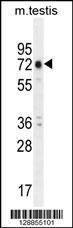 Anti-ANKEF1 Rabbit Polyclonal Antibody (HRP (Horseradish Peroxidase))