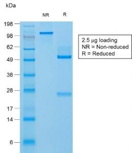 SDS-PAGE analysis of Anti-Filaggrin Antibody [FLG/1957R] under non-reduced and reduced conditions; showing intact IgG and intact heavy and light chains, respectively. SDS-PAGE analysis confirms the integrity and purity of the antibody.