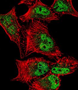 Anti-MEF2C Rabbit Polyclonal Antibody (FITC (Fluorescein))