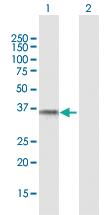 Anti-RHD Mouse Polyclonal Antibody