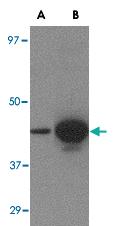 Anti-H5 Mouse Monoclonal Antibody [clone: 1E7D8]