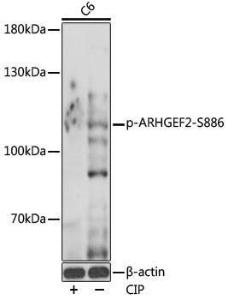 Western blot analysis of extracts of C6 cells, using Anti-GEF H1 (phospho Ser886) Antibody (A308539) at 1:1,000 dilution C6 were treated by CIP (20ul CIP for each 400ul cell lysate) at 37°C for 1 hour