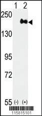 Anti-CHST14 Rabbit Polyclonal Antibody