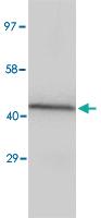 Anti-NPHS2 Rabbit Polyclonal Antibody