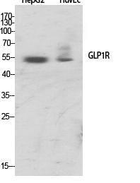 Western blot analysis of various cells using Anti-GLP1R Antibody